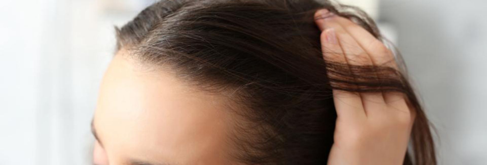 Haartransplantation für Frauen
