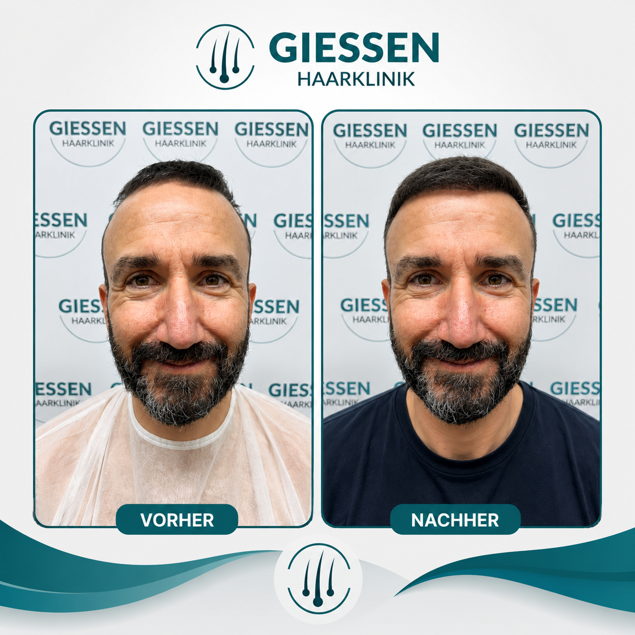 Giessen Haar Ergebnis 3
