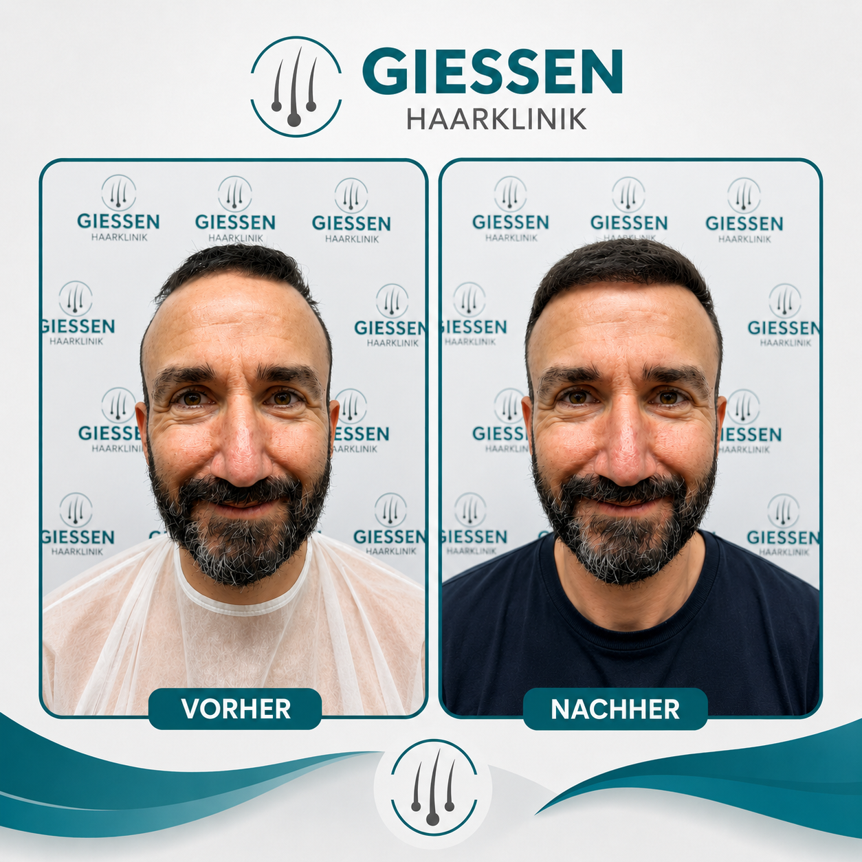 Giessen Haar Ergebnis 3